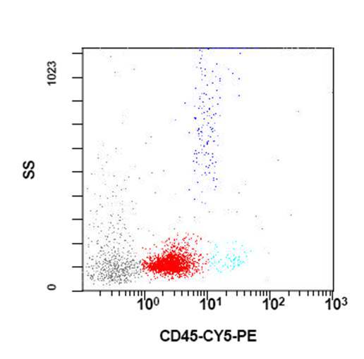 Flow cytometry of mediastinal mass FNA